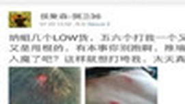 爱国不容置疑 遑论泄愤暴殴