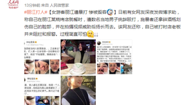 详解丽江毁容案警方怎样利用法律包庇嫌疑人
