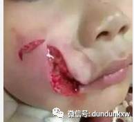 剖析“极端爱狗”背后的庞大黑色利益链