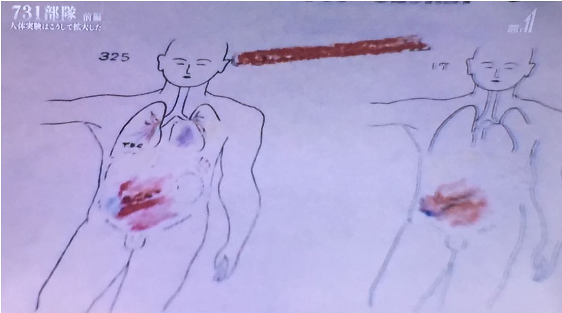 731部队——人体实验是这样展开的