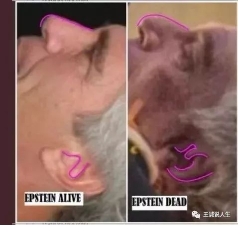 王诚：爱泼斯坦之死，以及他一生中不为人知的故事